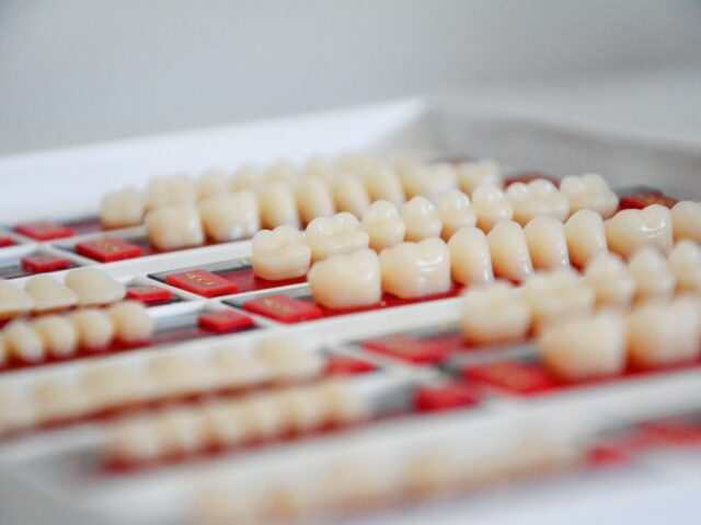 Dental Veneers