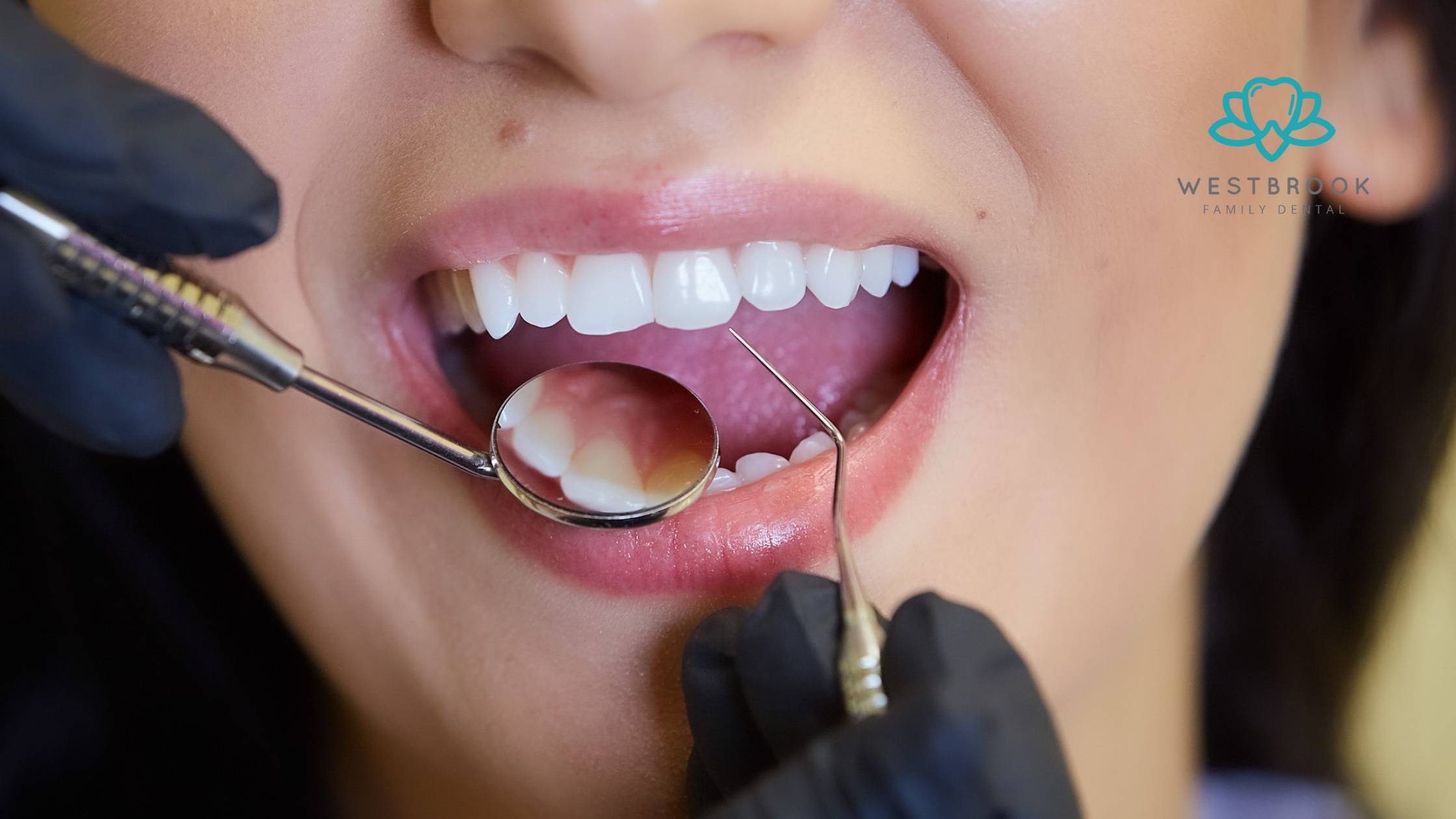 The Gold Standard in