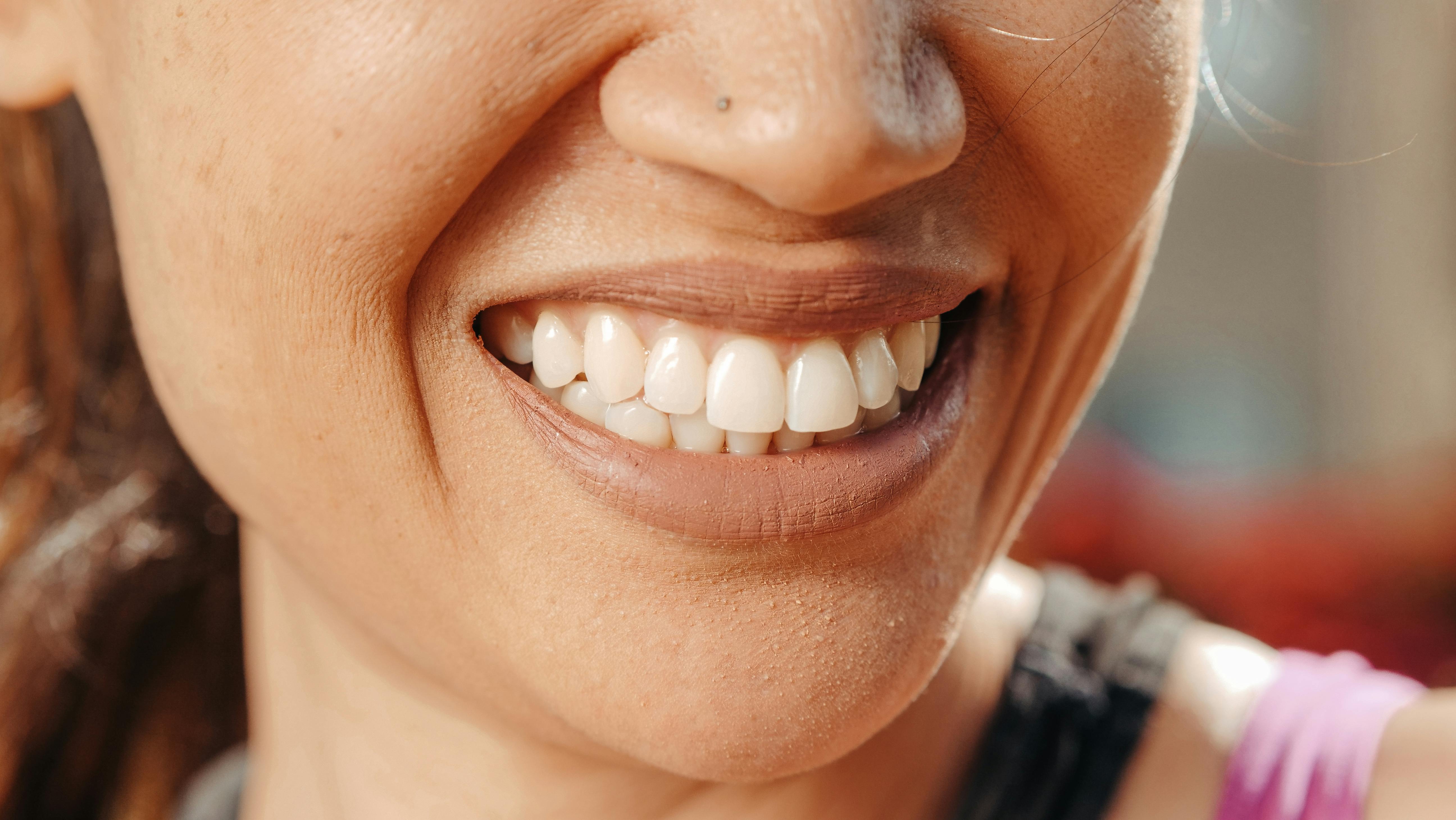 Confident Smile